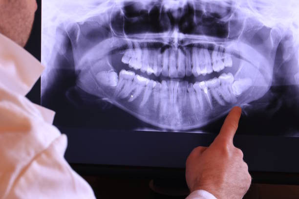 Best Urgent Care for Lost Fillings or Crowns in Melrose, MA