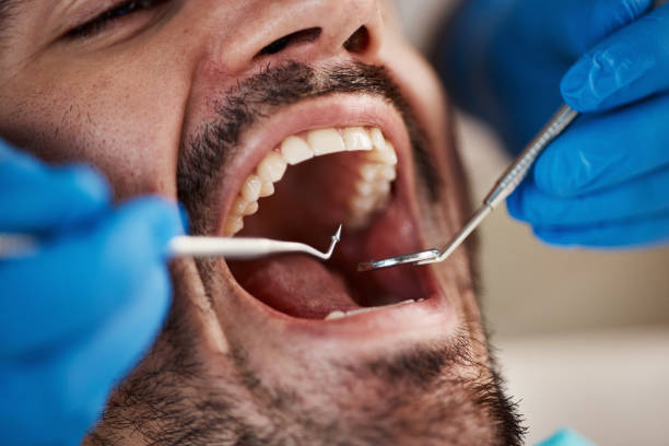 Best Emergency Denture Repair in Melrose, MA